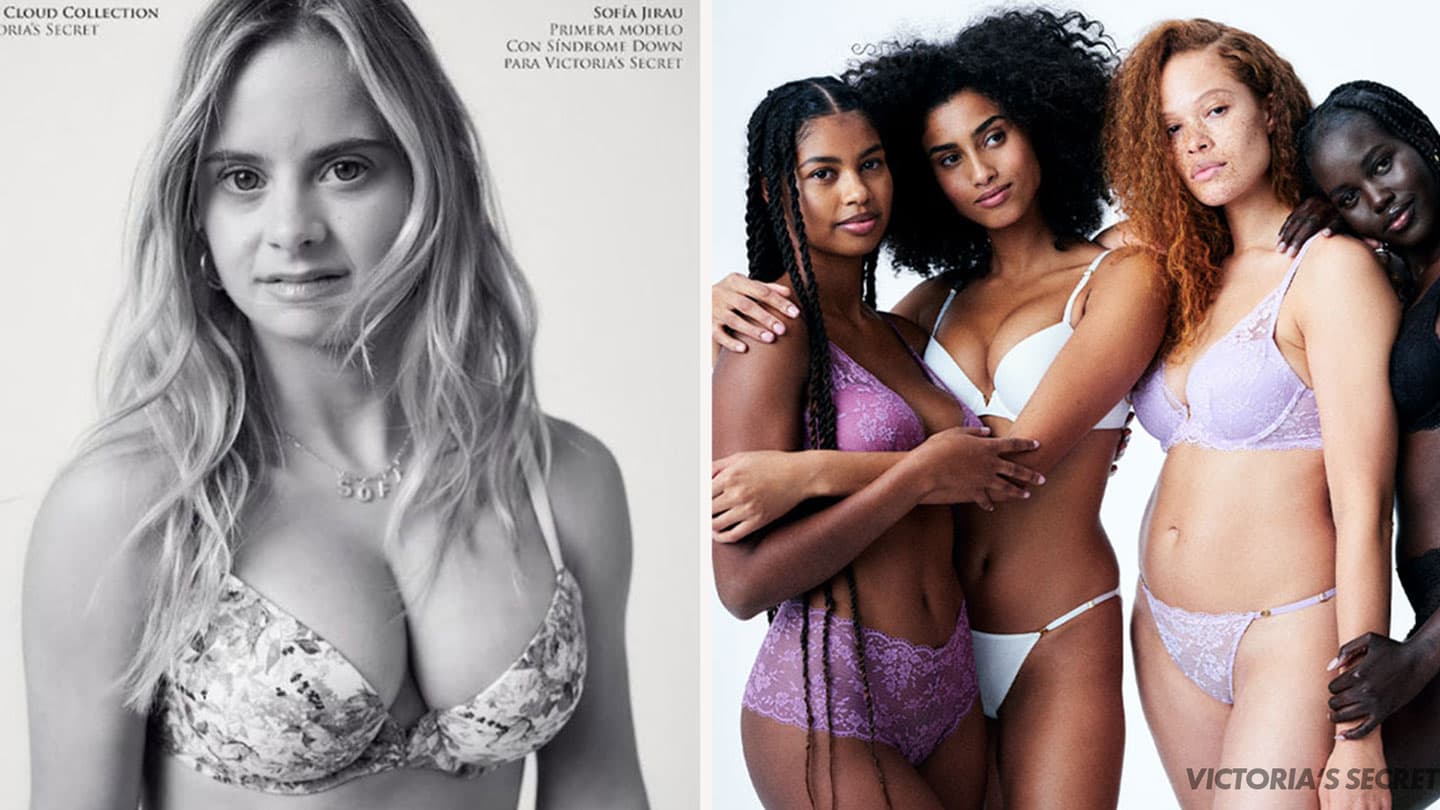 VSDownSyndromeModelFacebookThumb2