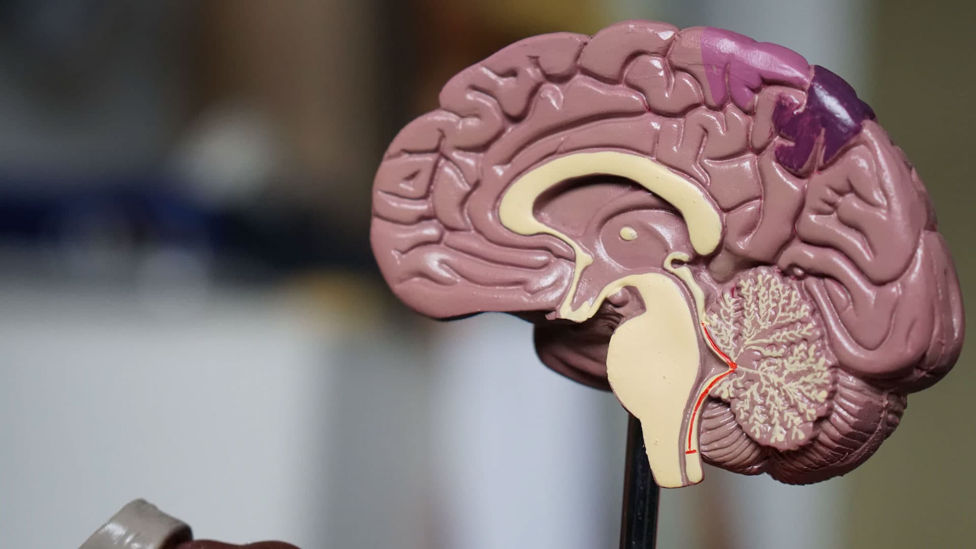 brain22FEATUREDIMAGE